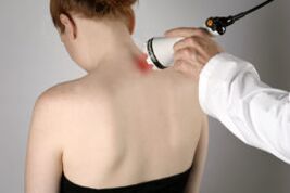 Cervical osteochondrosis treatment with laser therapy